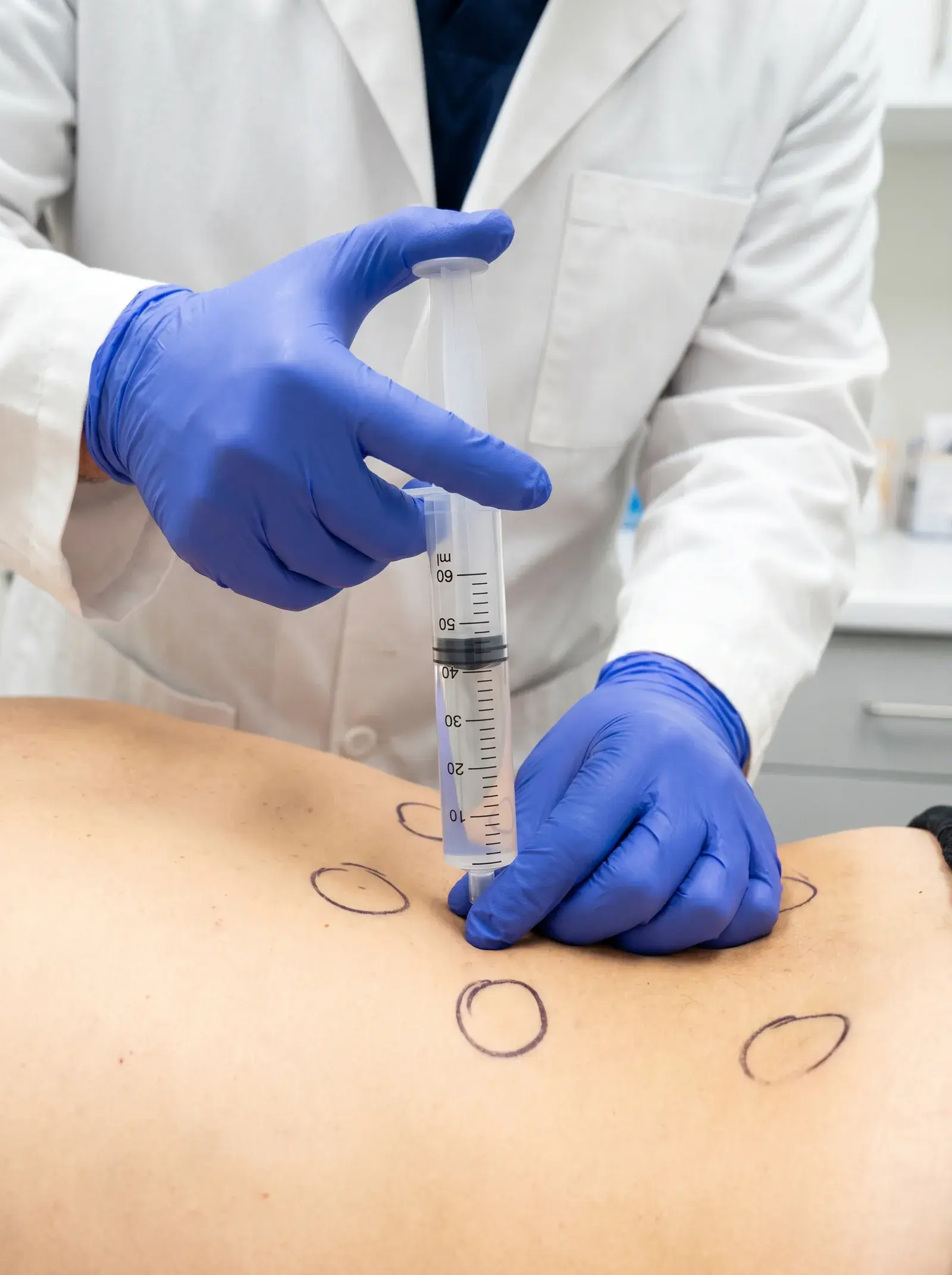 Ozonioterapia