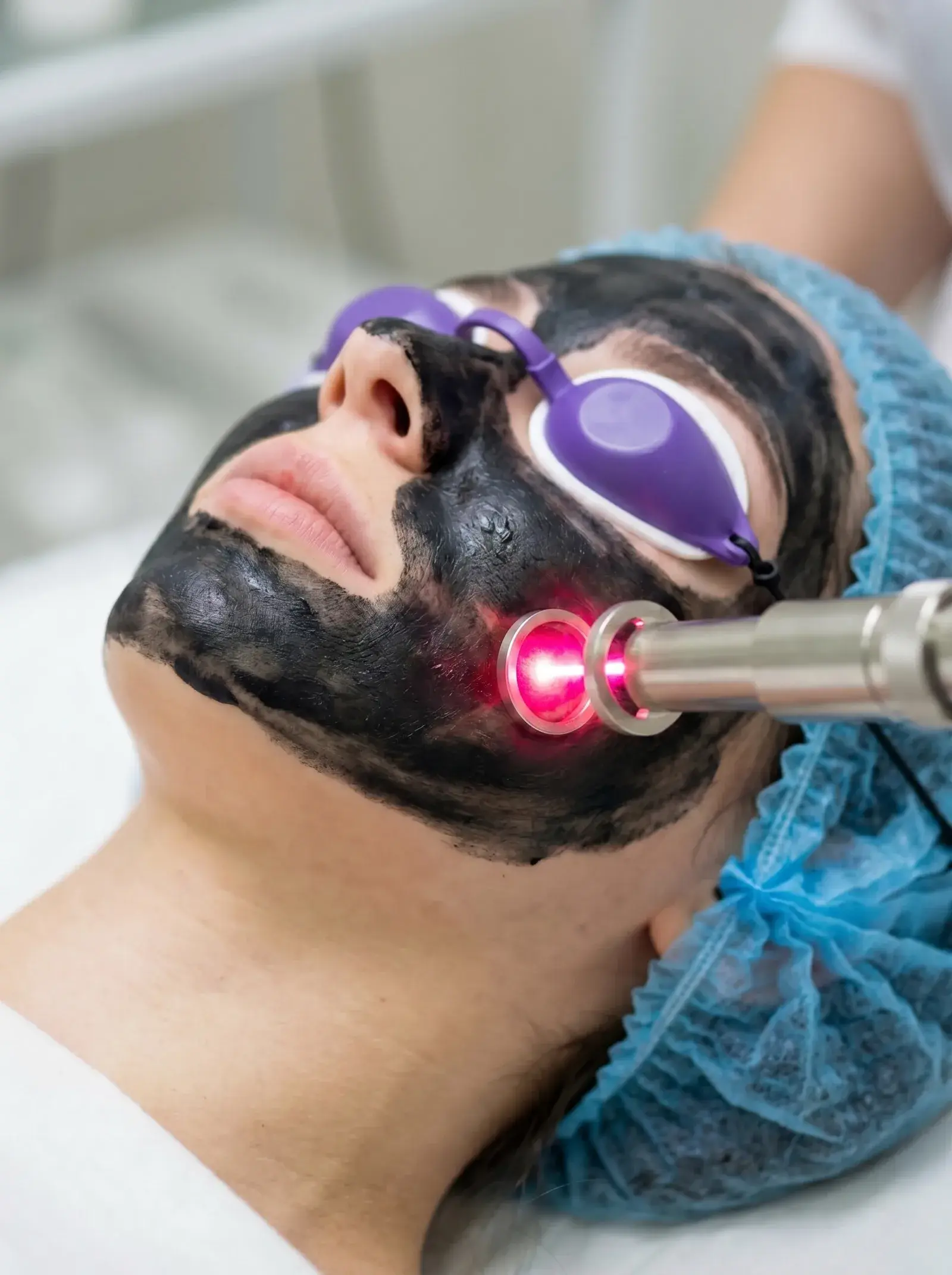 Rejuvenescimento Facial a Luz Pulsada